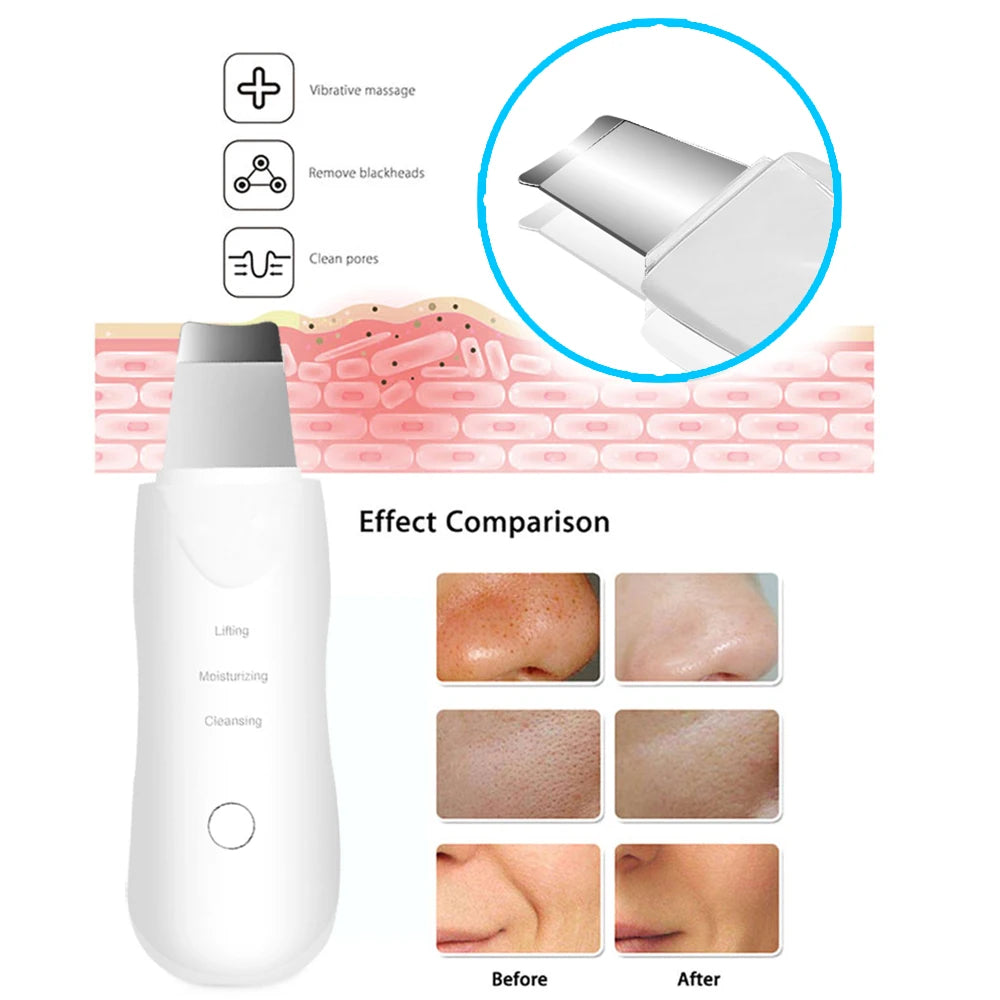 GlowLift Skin Wand
